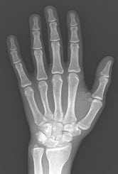 x-ray hand
